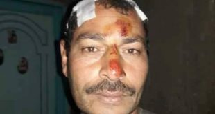 احد المصابين الأقباط