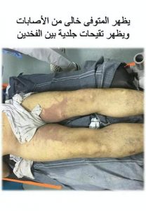 fb_img_1479505079427